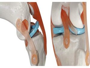 Human Knee Joint Simulation Model Anatomy Teaching Model - Image 5