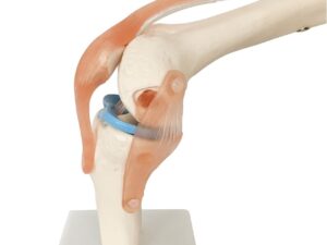 Human Knee Joint Simulation Model Anatomy Teaching Model - Image 3